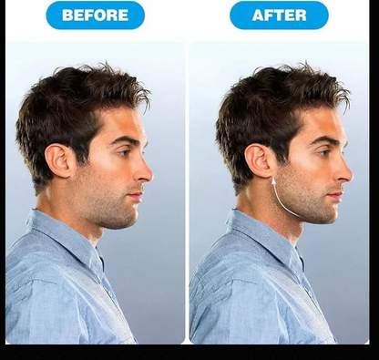 Jaw Shaper & Facial Toner | Sculpt, Shape & Lift | Compact Jaw Exerciser